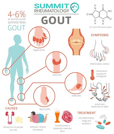 What Helps With Gout Pain