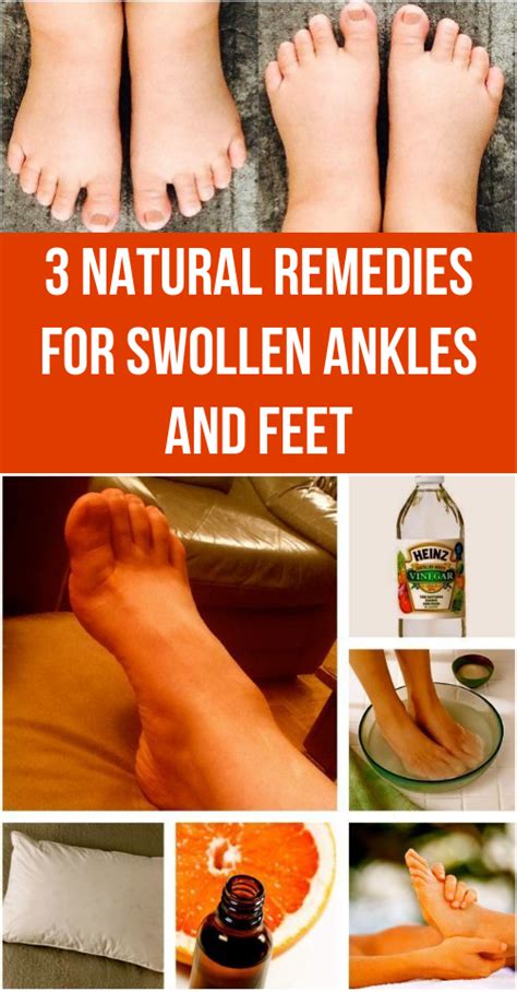 What Helps With Swollen Feet
