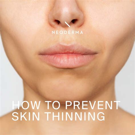 What Helps With Thinning Skin