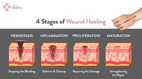 What Helps With Wound Healing
