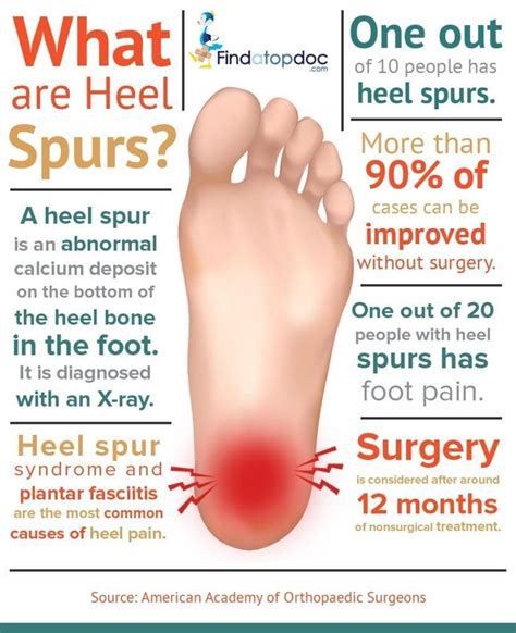 What Is A Heal Spur