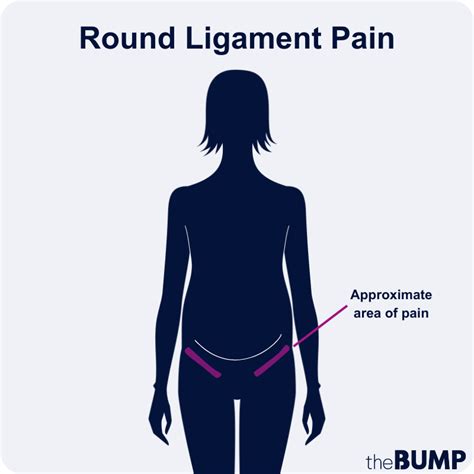 What Is Round Ligament Pain