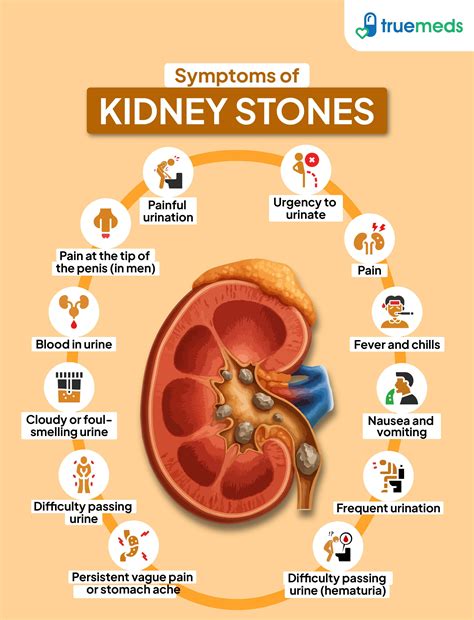 What Is The Smell Of Kidney Stone
