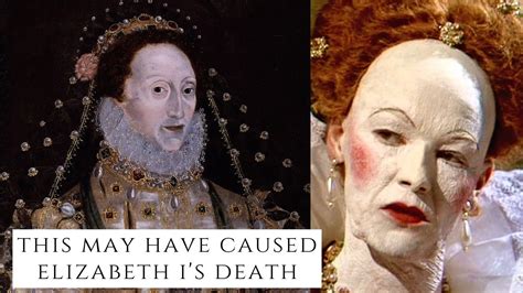 What Killed Queen Elizabeth 1