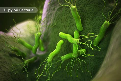 What Kills H. Pylori Bacteria