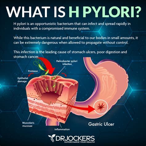 What Kills H Pylori