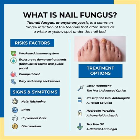 What Kills Toenail Fungus Instantly