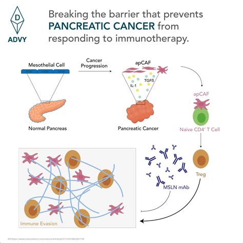 What Prevents Pancreatic Cancer