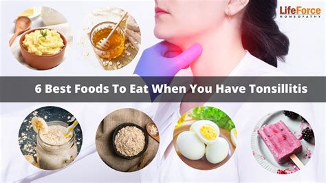 What To Eat After Tonsillectomy