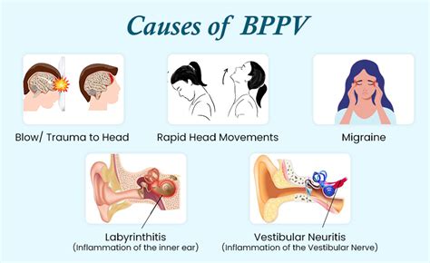 What Triggers Bppv Attacks