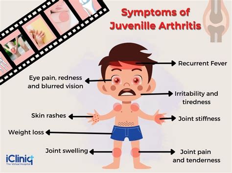 What Triggers Juvenile Arthritis