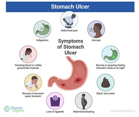 What Triggers Ulcer