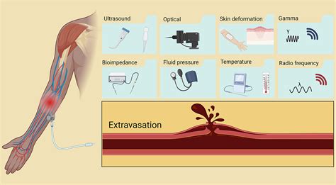 When To Avoid Iv Contrast