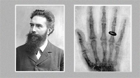 Who Invented X Ray