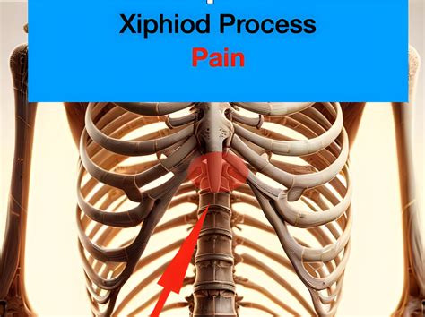 Xiphoid Process Hurts