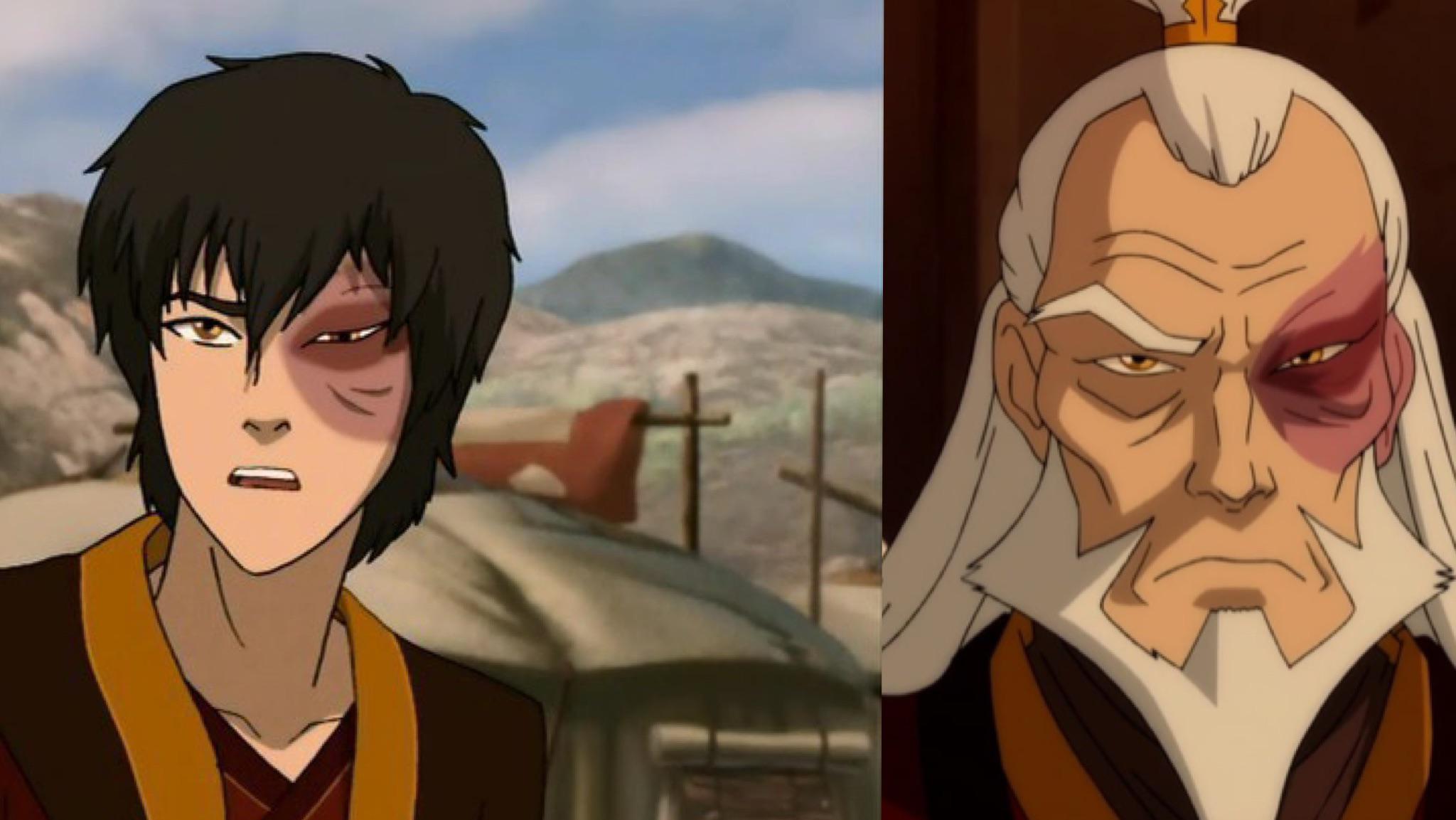 Zuko Young Vs Old: How The Fire Lord Evolved Through The Years
